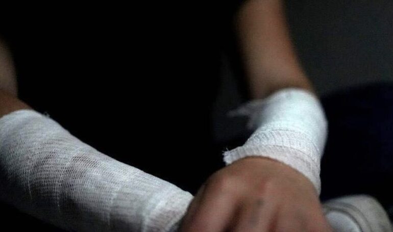 Brutal ataque en Santo Domingo: Niña de 11 años es amarrada y quemada viva por otras menores en Cancino Adentro