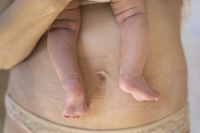 Cirugía plástica y maternidad: una decisión consciente hacia el bienestar