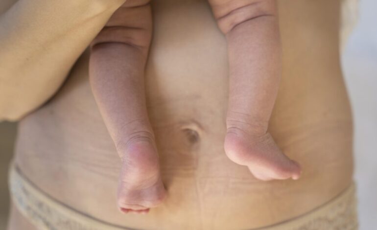 Cirugía plástica y maternidad: una decisión consciente hacia el bienestar