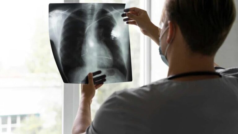 Estudio de Mayo Clinic destaca eficacia de la broncoscopia robótica para detectar cáncer de pulmón