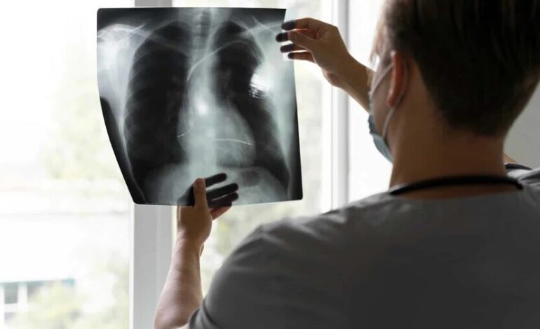 Estudio de Mayo Clinic destaca eficacia de la broncoscopia robótica para detectar cáncer de pulmón