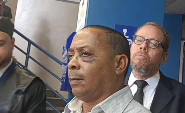 Chofer de TRAE rechaza disculpas de motorista agresor