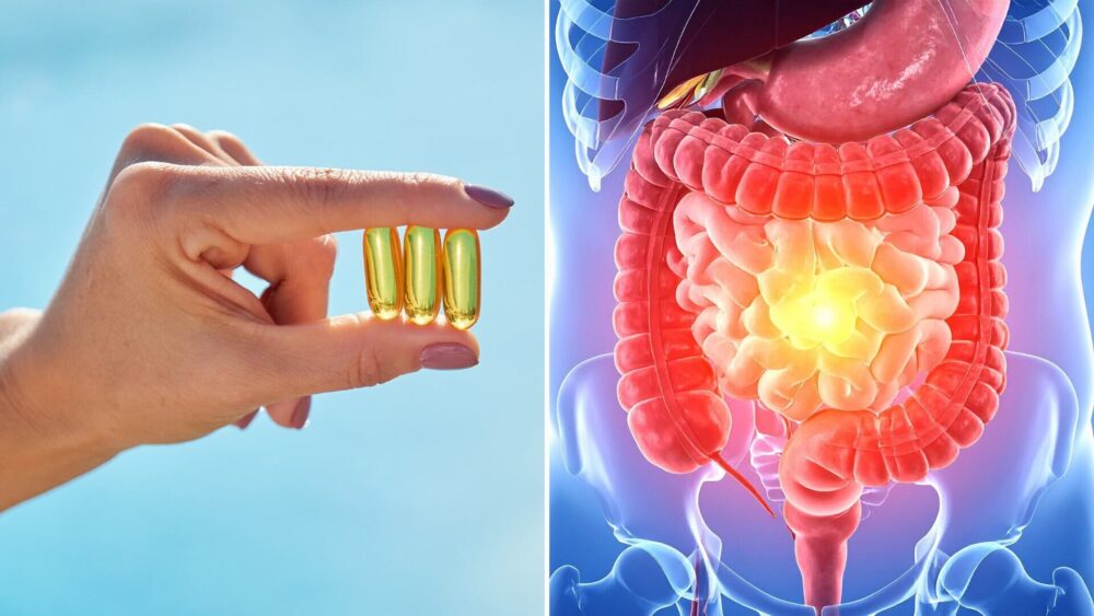 Estudio vincula la vitamina D con mejoras inmunológicas en pacientes con EII