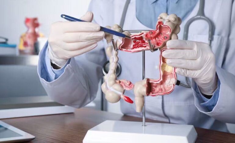 Especialistas alertan sobre aumento de cánceres gastrointestinales en jóvenes