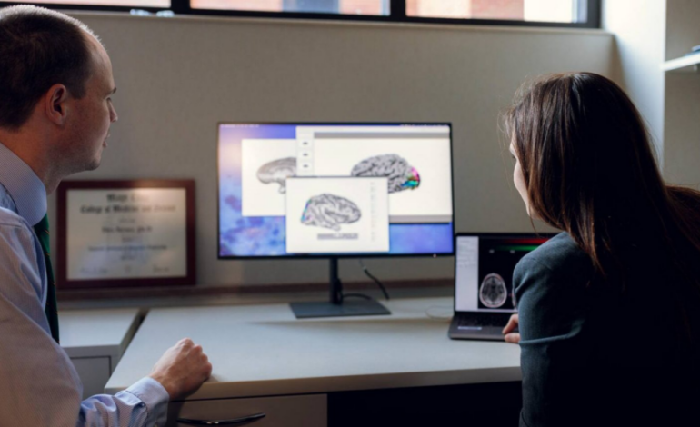 Nuevo mapa del cerebro podría transformar el tratamiento personalizado de la epilepsia
