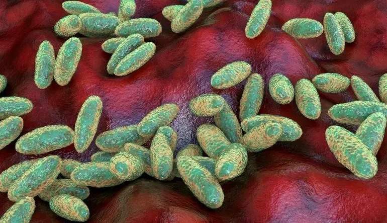 Peste neumónica: OMS pide respuestas a Rusia tras muerte en laboratorio