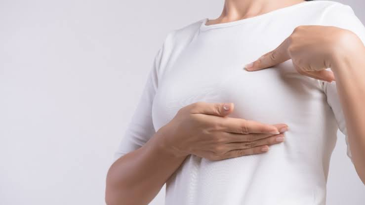 Cáncer de mama inflamatorio: señales de alerta que pueden aparecer sin un bulto