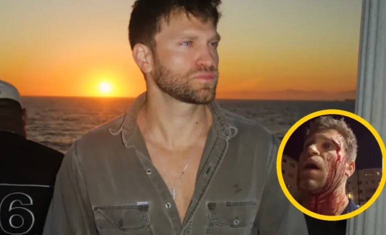 Keegan Allen denuncia brutal asalto a punta de pistola