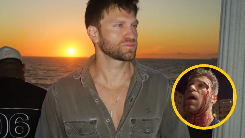 Keegan Allen denuncia brutal asalto a punta de pistola
